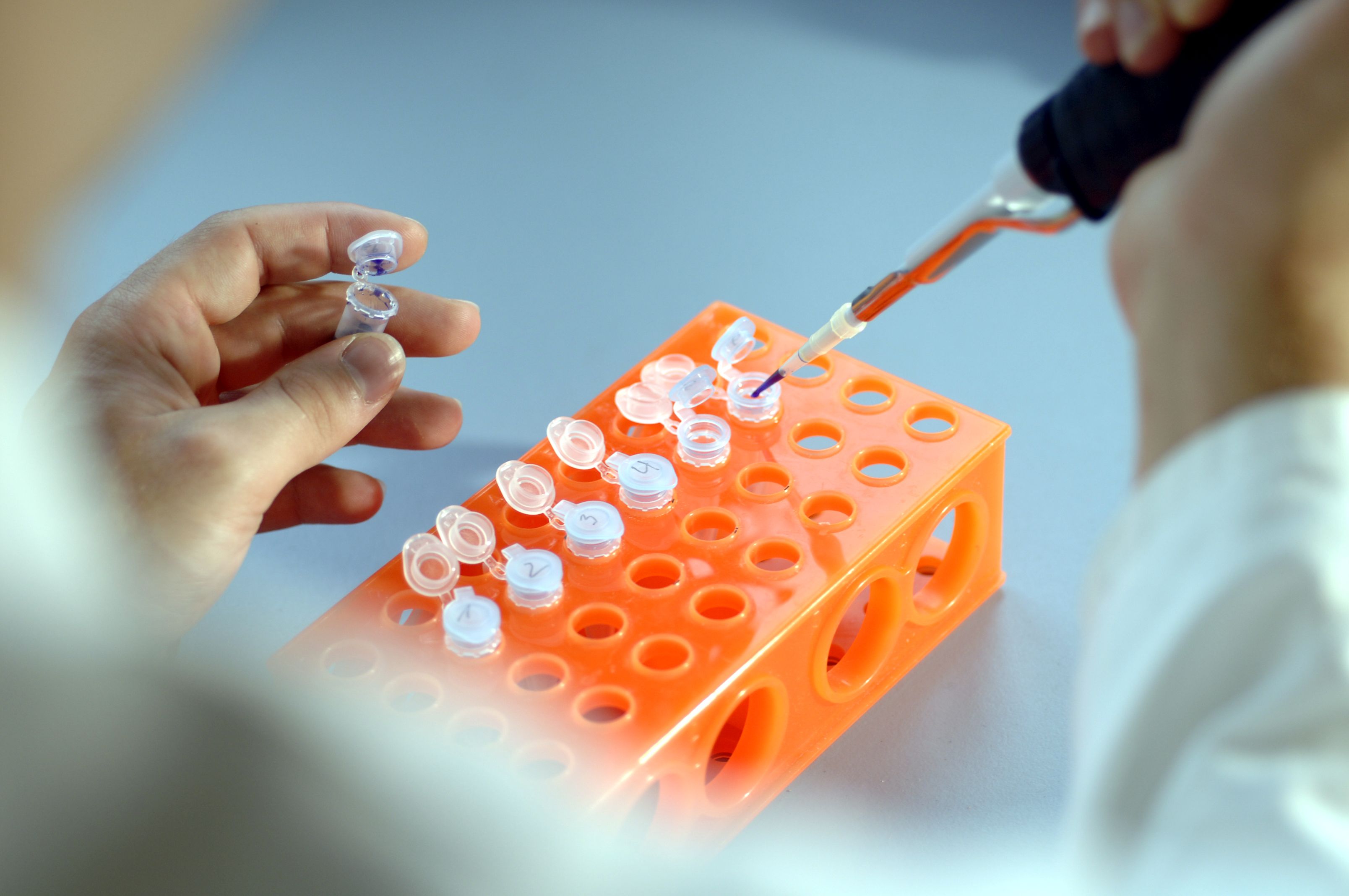 Vorbereitung einer DNA Probe im Labor. grüne gentechnik, grüne gentechnologie